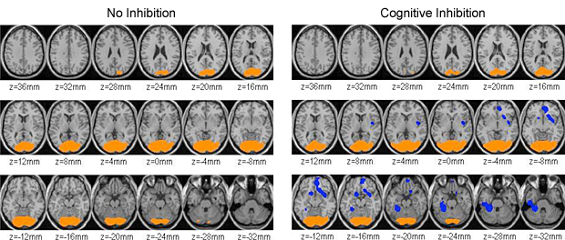 brain scans